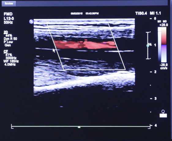 Ultrasound